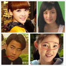 那些整容失败的明星,揭秘那些失败的整形案例